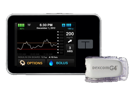 Tandem t:slim and Dexcom